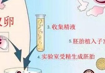 怎么提高三特需数量？