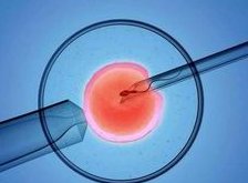 女性停经后能否做试管婴儿：2026年的探讨与解析